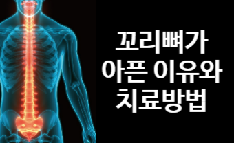 꼬리뼈가 아픈 이유