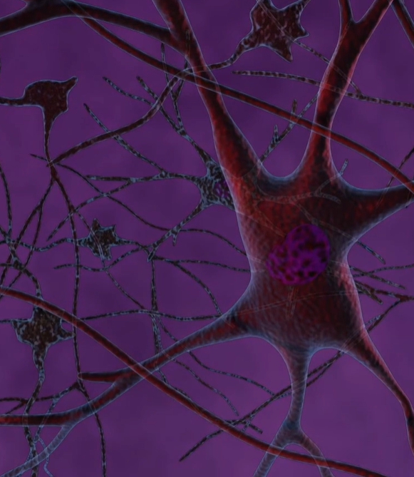 뇌경색 전조증상