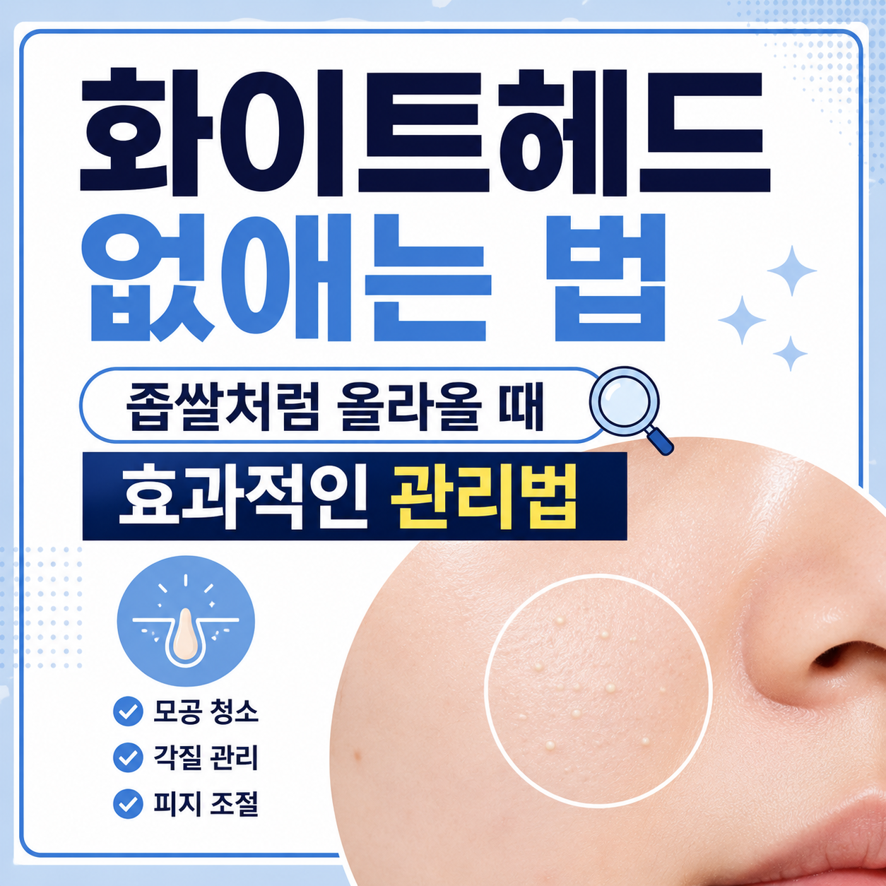 화이트헤드 없애는 법
