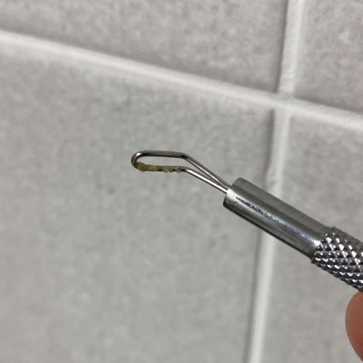 압출기로-긁어낸-피지-사진