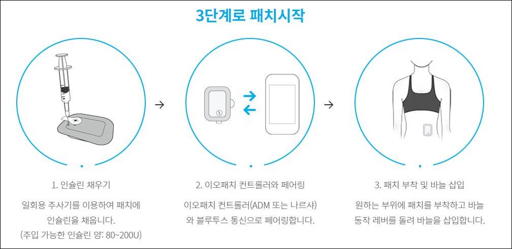 이오패치 사용