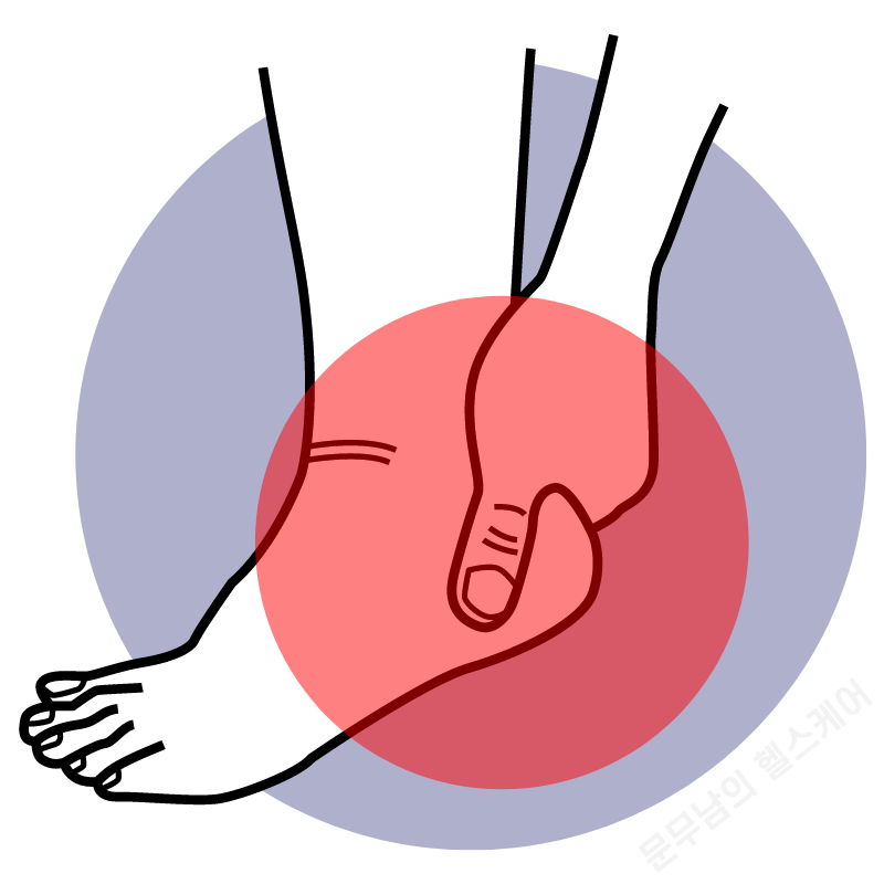 발목 통증 원인