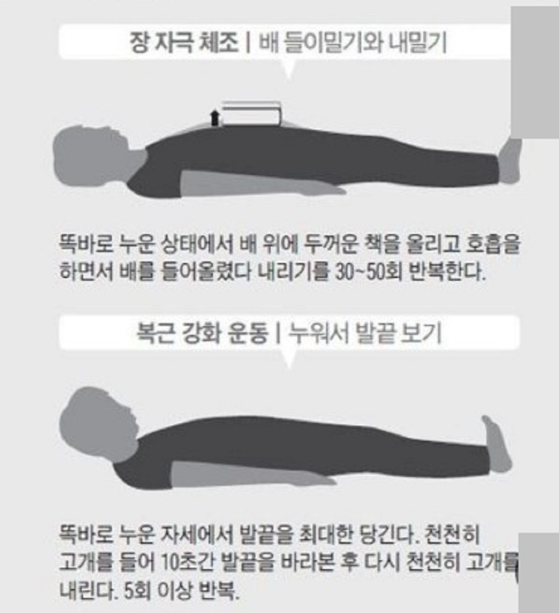 노인변비-정기욱-교수