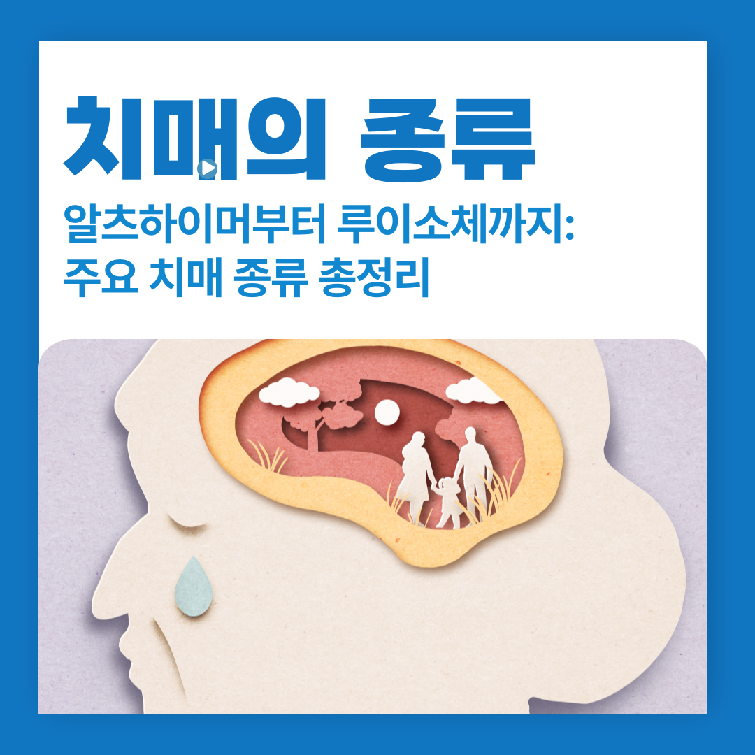 알츠하이머부터 루이소체까지: 주요 치매 종류 총정리