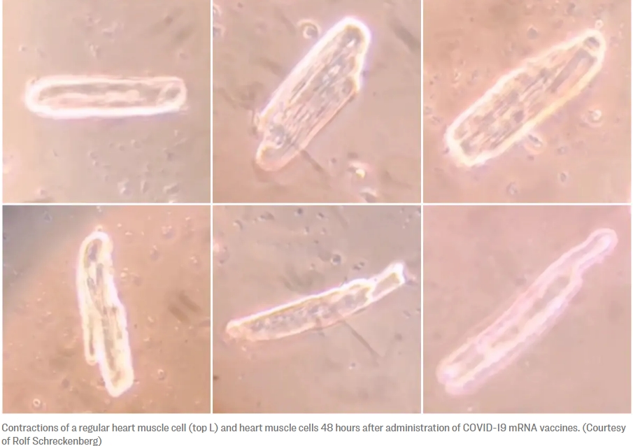 mRNA&nbsp;코로나&nbsp;백신,&nbsp;심장&nbsp;세포에&nbsp;스파이크&nbsp;단백질&nbsp;형성...심장&nbsp;수축 발견&nbsp;이상:&nbsp;연구&nbsp;결과