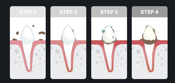 강아지 치석쌓이는단계
