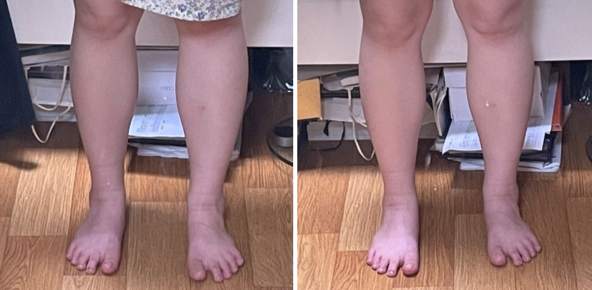 뉴베인 내돈내산 효과