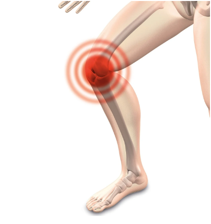 관절 건강을 위한 글루코사민과 MSM의 차이