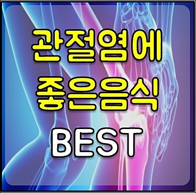 관절염에 좋은 운동 1
