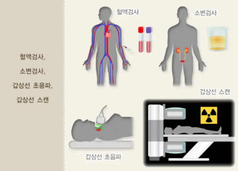 부정맥-심장이외질환-검사