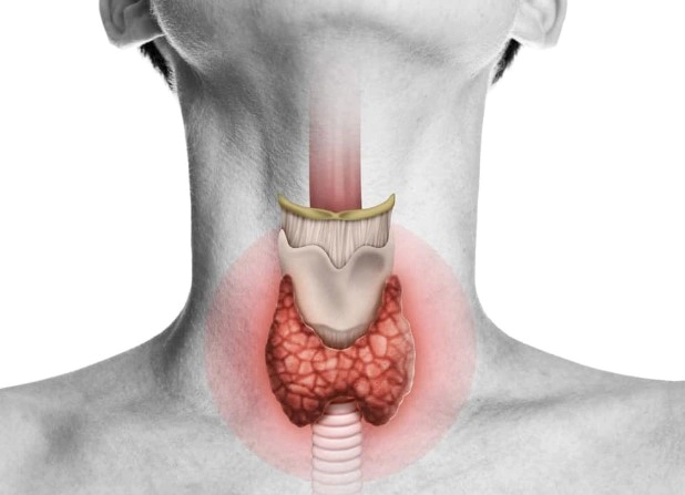 갑상선기능저하증 증상 34가지