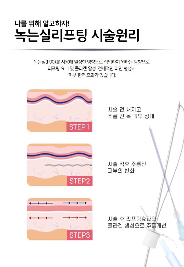 미니 리프팅 가격