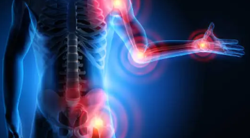 류마티스 관절염