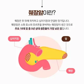 췌장암 초기 증상 췌장암 등통증 위치 검사_22
