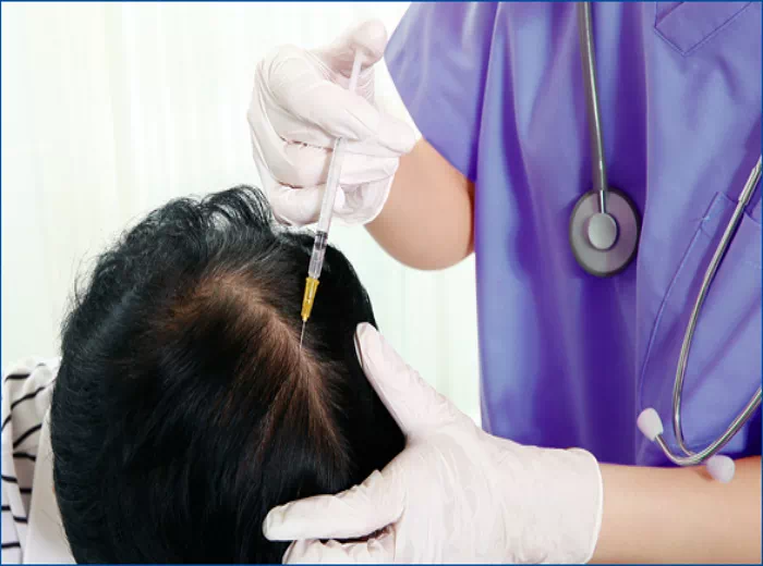 두피탈모보톡스