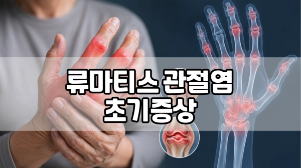 류마티스 관절염 초기증상