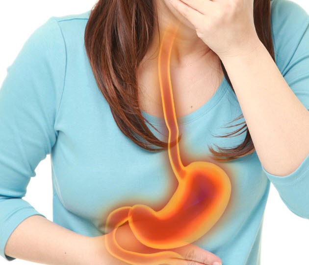 여성 역류성식도염