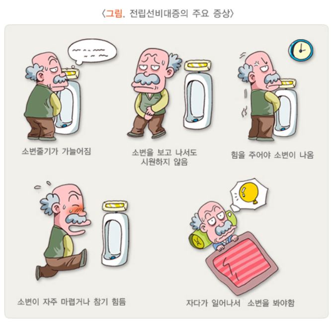전립선비대증의-주요-증상을-표현한-그림