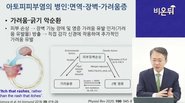 아토피피부염
