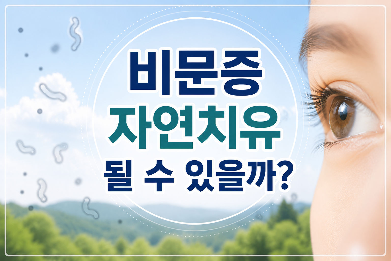 비문증 자연치유 될 수 있을까?