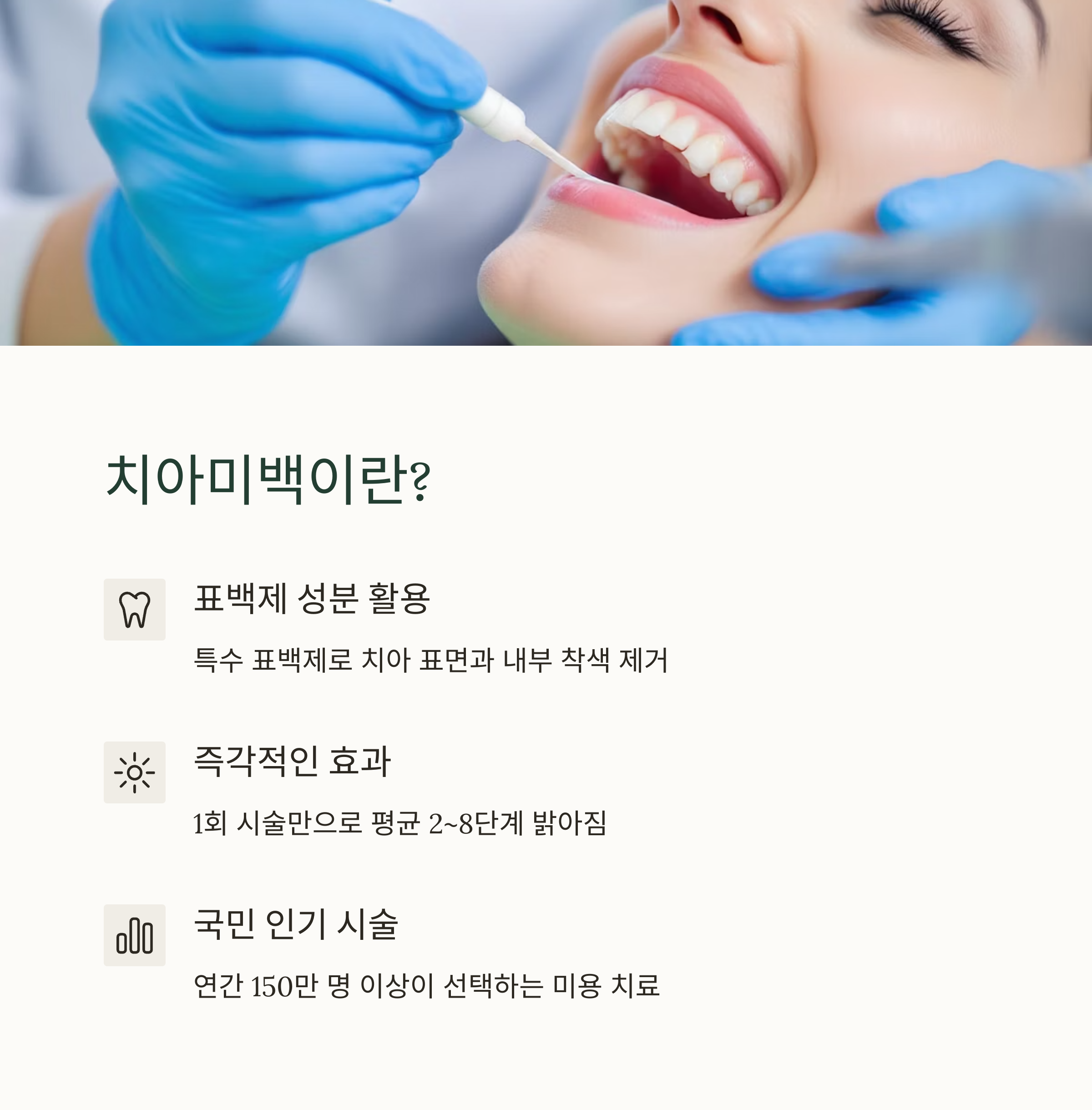 치아미백 가격과 종류 총정리