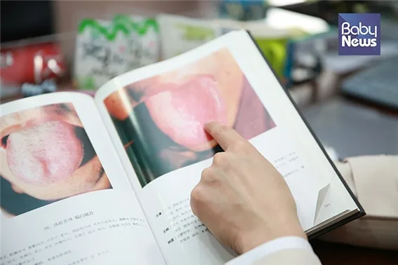 혓바늘이 돋는 이유