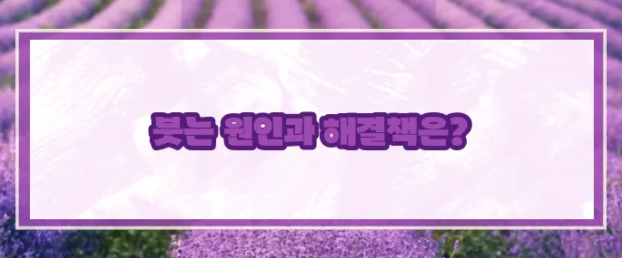 눈두덩이가 붓는 이유 (+대처방법)