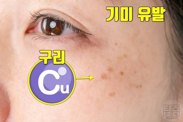 기미 제거 음식 천연 기미치료제 식품 구리