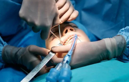 65세이상-임플란트-정부지원-받는방법