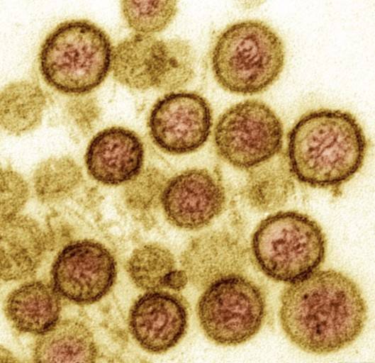 신증후군출혈열 예방방법