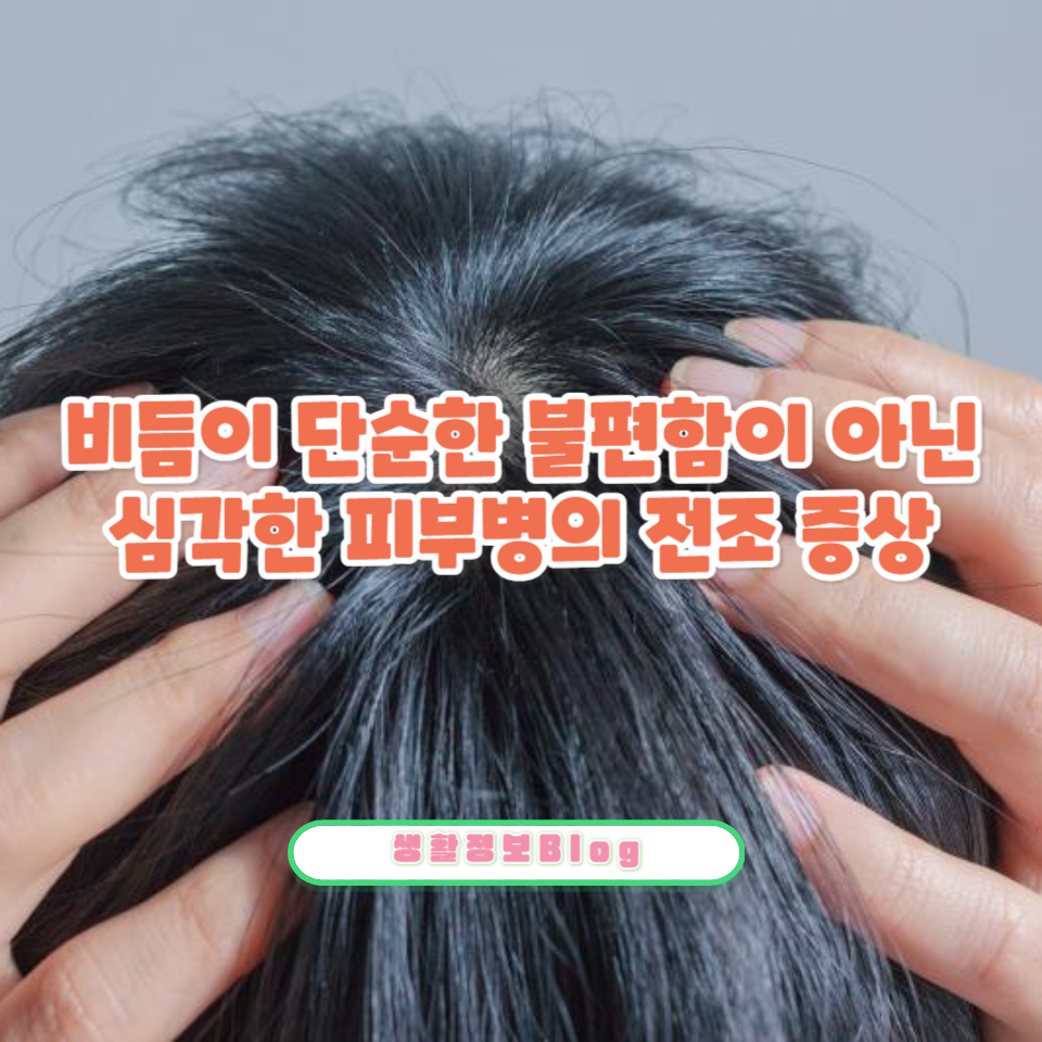 피부병으로 발전할 수 있는 신호