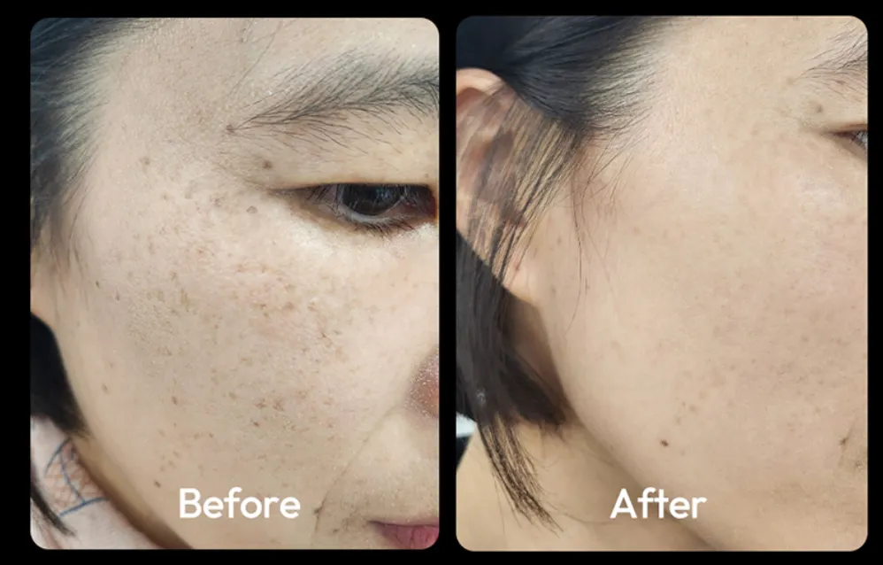 식스킨-볼케이노샷-정식몰-바로가기