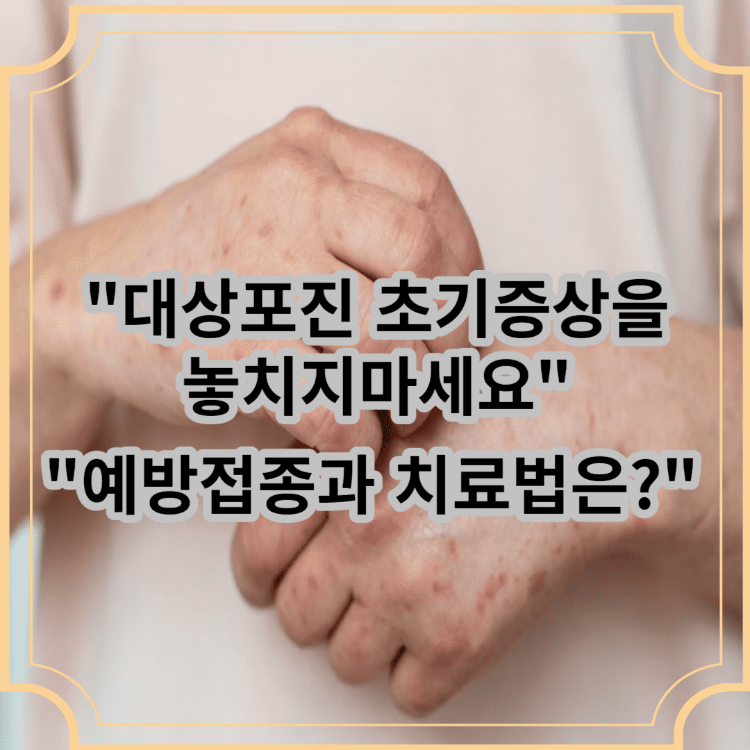 대상포진 초기증상을 놓치지마세요.예방접종과 치료법은?