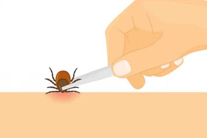 옴 진드기 증상과 치료법, 전염 예방까지 알아야 할 모든 것