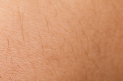 쯔쯔가무시 진드기 물린 자국