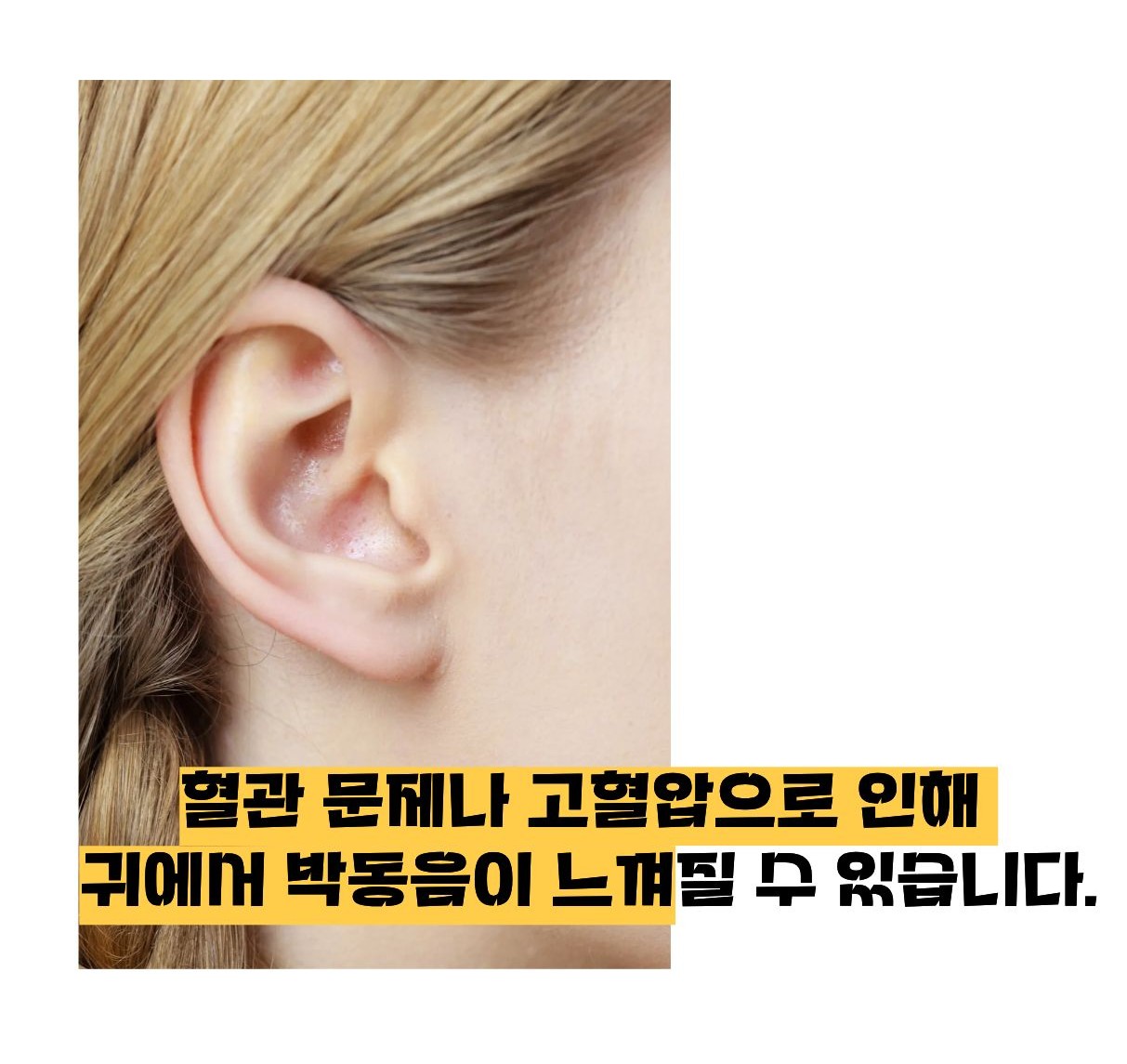 귀에서 심장박동소리