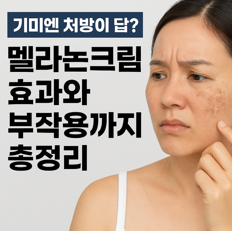 멜라논크림 효과와부작용 정리