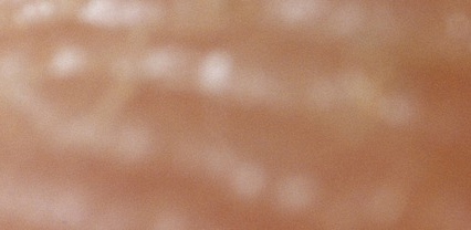 모기