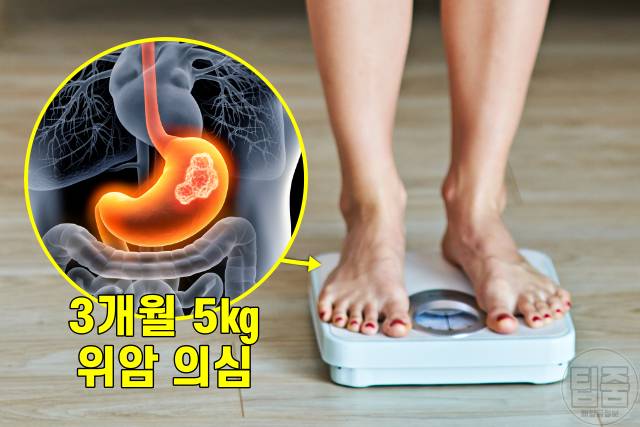 암 초기증상,위암 식도암 증상