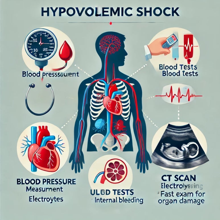저혈량 (Hypovolemia)