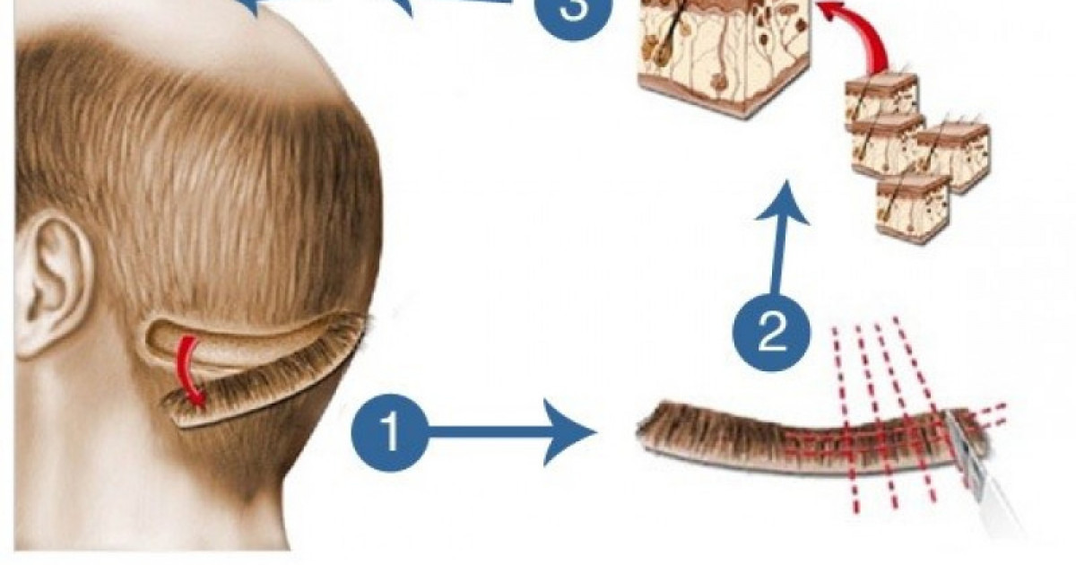 병원별 시술 방식&middot;비용 비교 (서울 강남/압구정)