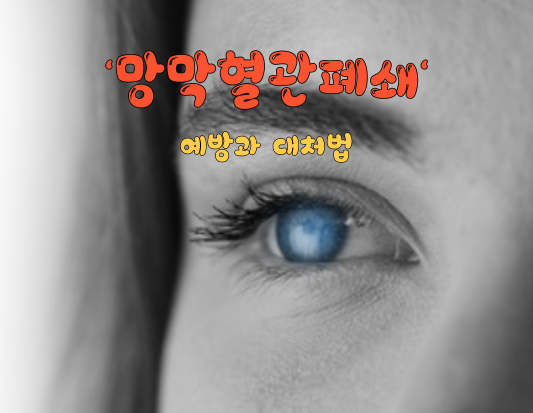 겨울철 주의해야 할 망막혈관폐쇄&#44; 예방과 대처