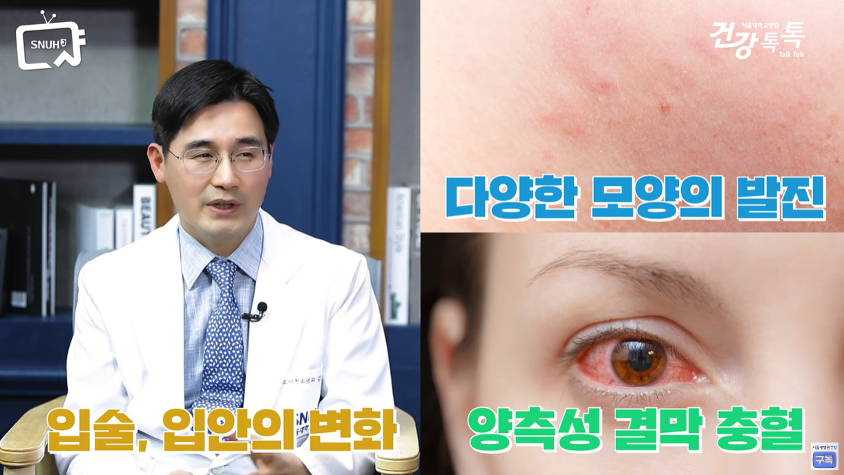 입술, 입안 모양 변화, 충혈, 발진등이 발생함