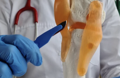 무릎 연골 치료 사진