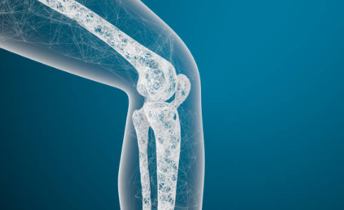 골다공증 증상&amp;#44; 수치&amp;#44; 골다공증에 좋은 음식 총정리 (2024ver)