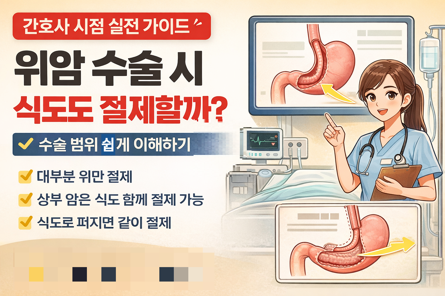 위암 수술 시 식도 절제 여부와 위 절제 범위를 설명하는 의료적 이미지
