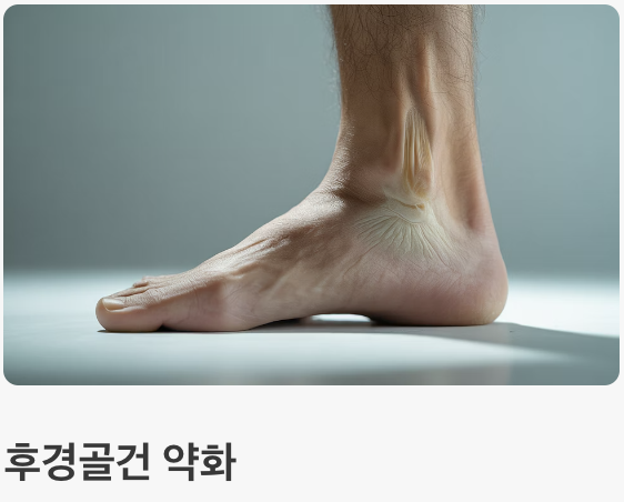 방치하면 '평발'이 심해질 수 있어요
