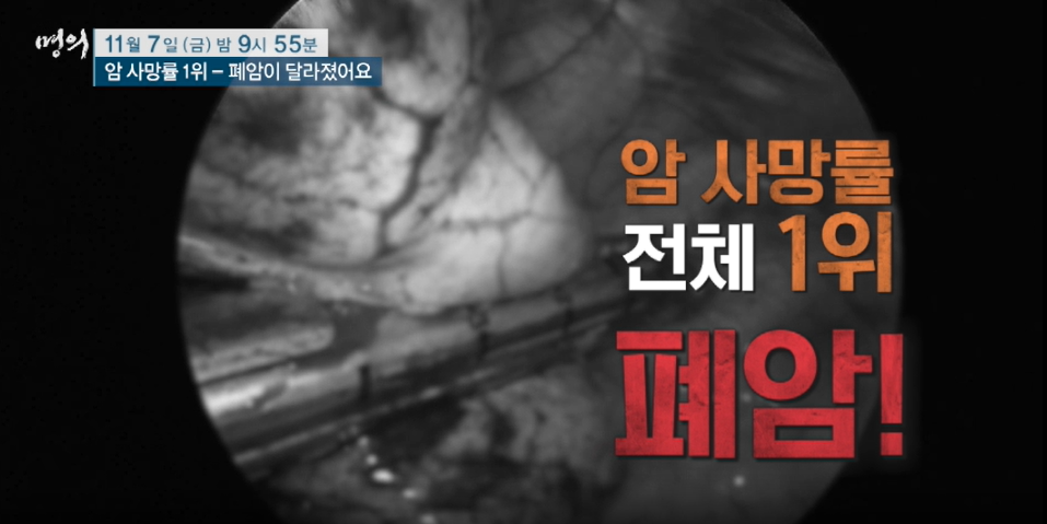 명의 폐암이 달라졌어요