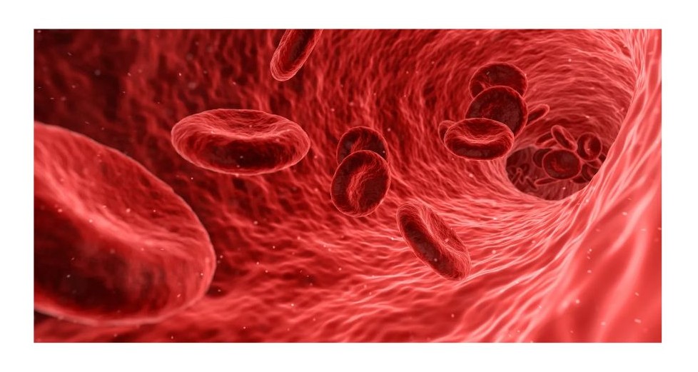 경동맥 협착증 치료