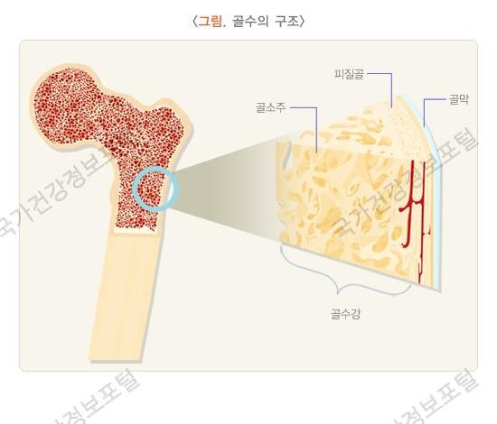 골수염 증상